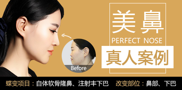 鼻部案例专题