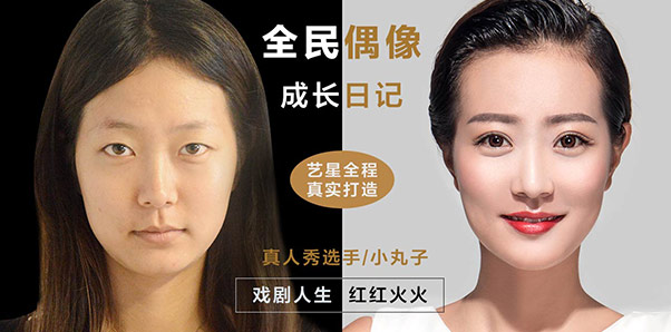 小丸子-双眼皮