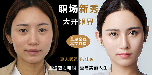 佳玲-双眼皮