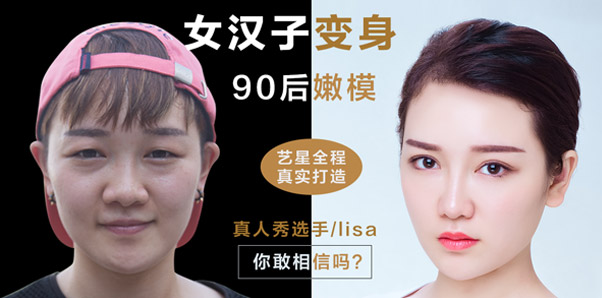 Lisa -眼鼻案例