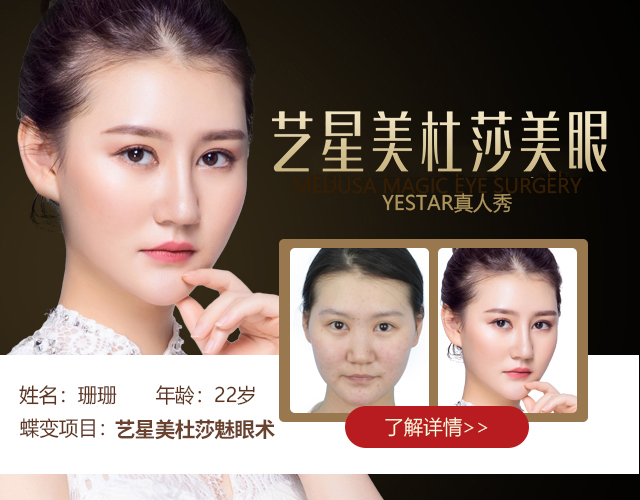 肉毒素除皱